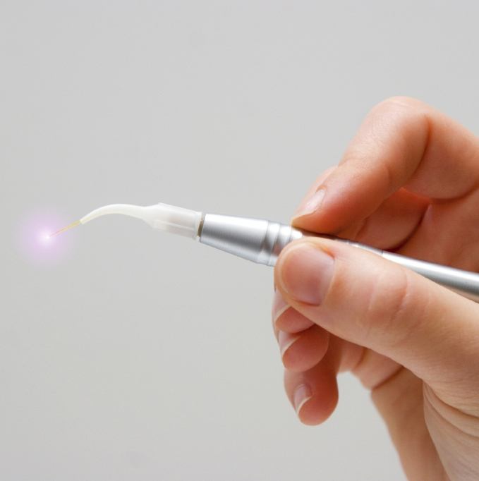 Hand holding a soft tissue dental laser