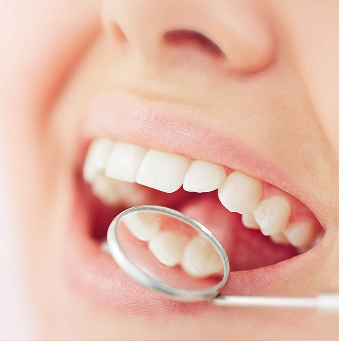 Checking teeth with a dental mirror