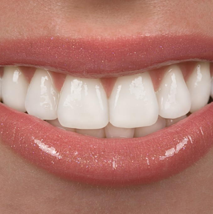 Close up of beautiful teeth smiling