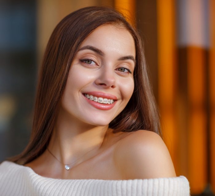 Woman wearing braces for orthodontics in San Jose